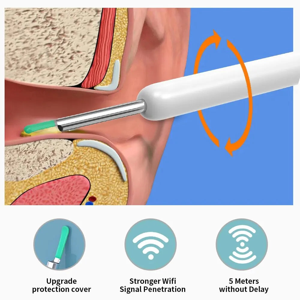 Ear Wax Removal Tool with HD Ear Camera 1080P Ear Scope Otoscope Replacement Tips for Ear Pick Safer Detachable Ear Scoop